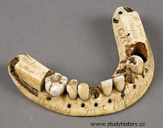 Waterloo, derrota de Napoleón y triunfo de los dentistas. 