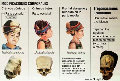 古代ペルーのトレパネーション 