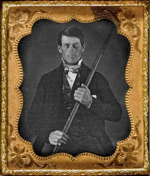 Phineas Gage:un hombre con el cráneo atravesado por una vara revolucionó la ciencia del cerebro 