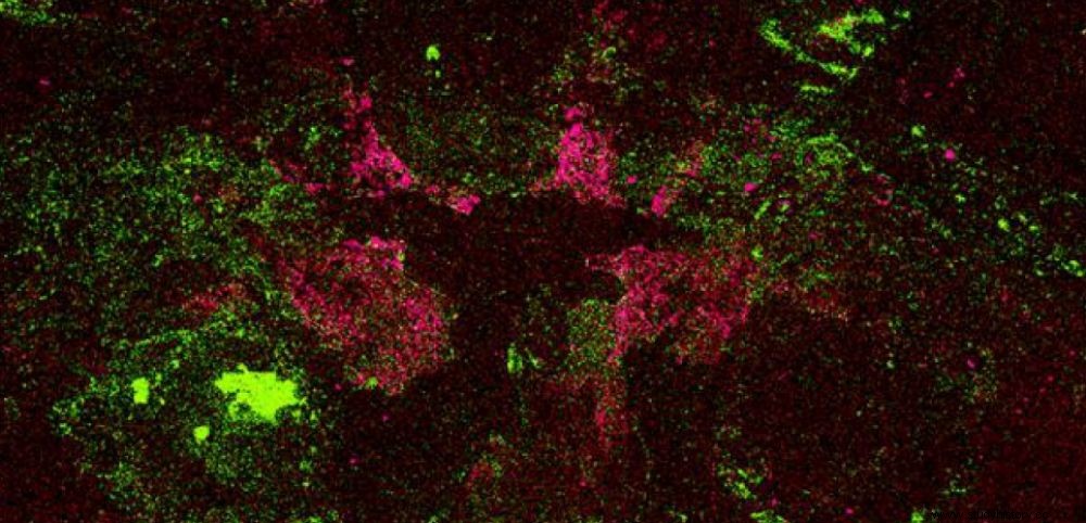 信じられない発見：5億2000万年前の脳の化石 