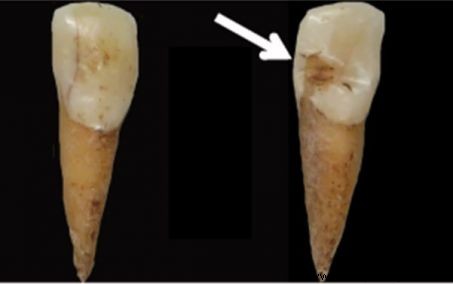 子どもの搾取、考古学者の新たな研究分野 