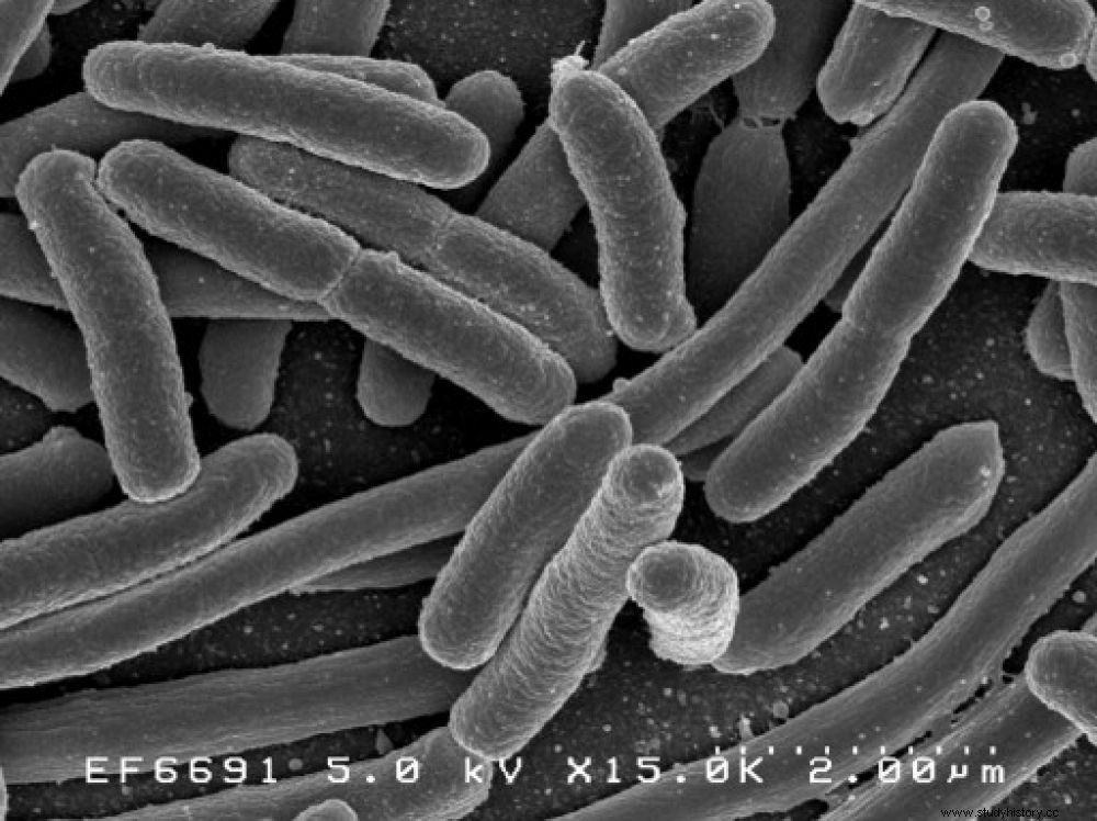 미라에서 추출한 고대 대장균(Escherichia coli) 