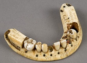 Waterloo, a defeat for Napoleon and a triumph for the dentists. 