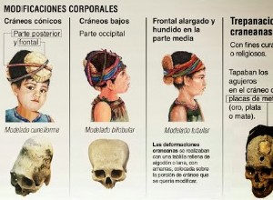 Trepanations in ancient Peru 