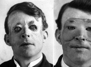 These masks changed the lives of horribly disfigured soldiers 