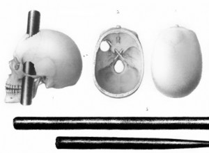 Phineas Gage - a man with a skull pierced by a rod revolutionized the science of the brain 