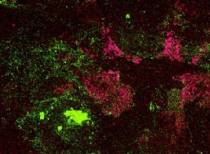 Incredible discovery:a 520 million year old brain fossil 