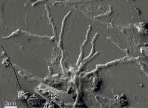 2,000-year-old neurons found intact in vitrified brain of Herculaneum victim 