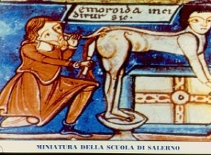 Hemorrhoids:in the Middle Ages they were treated (so to speak!) Like this! 